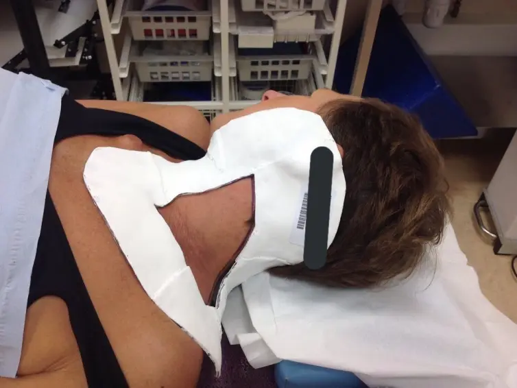 Jo Taylor with mask on to keep head still for radiotherapy.